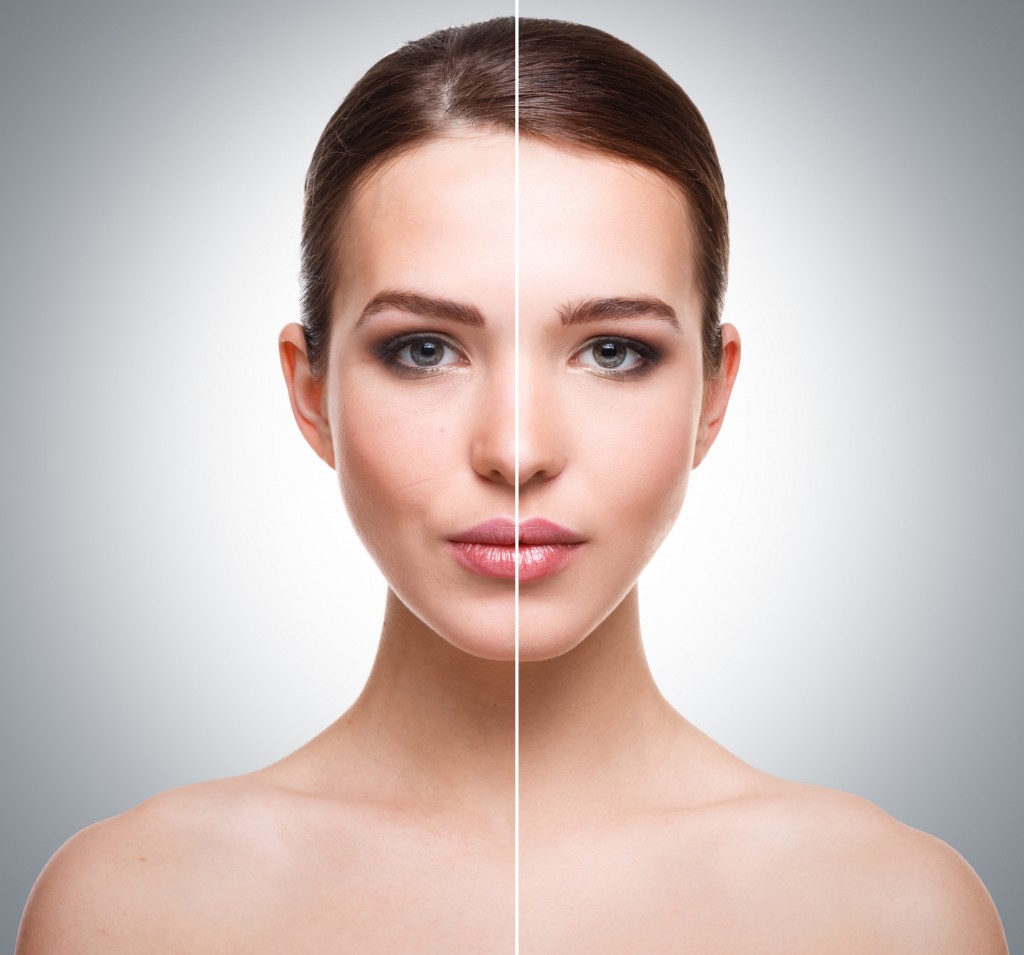 Peeling AHA. aspecto de la piel antes y después del trataiento