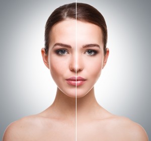 aspecto de la piel antes y después del trataiento